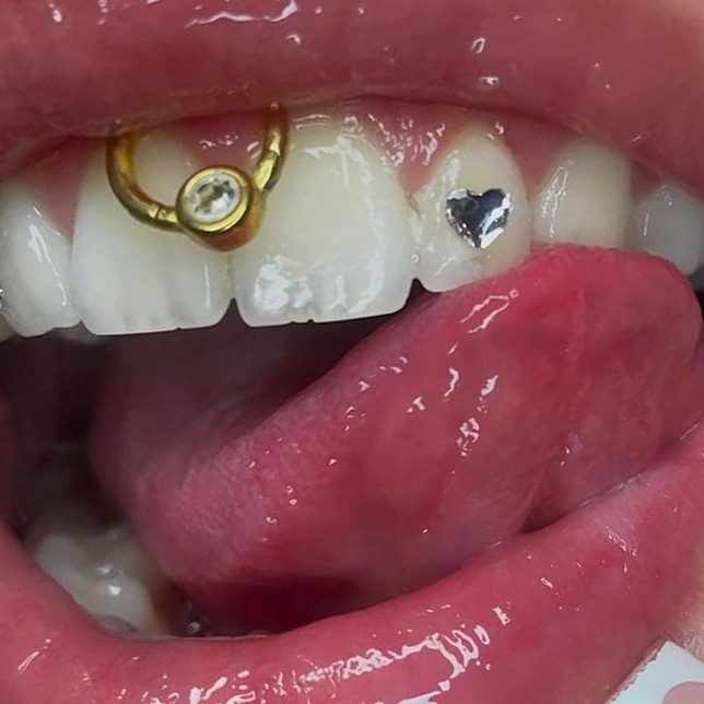 Toothgems: een gouden hartje met kristal en een zilver hartje op de voortanden